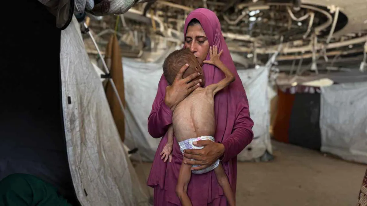 Cinco gazatíes, incluidos un bebé y dos niños, mueren por desnutrición en 24 horas