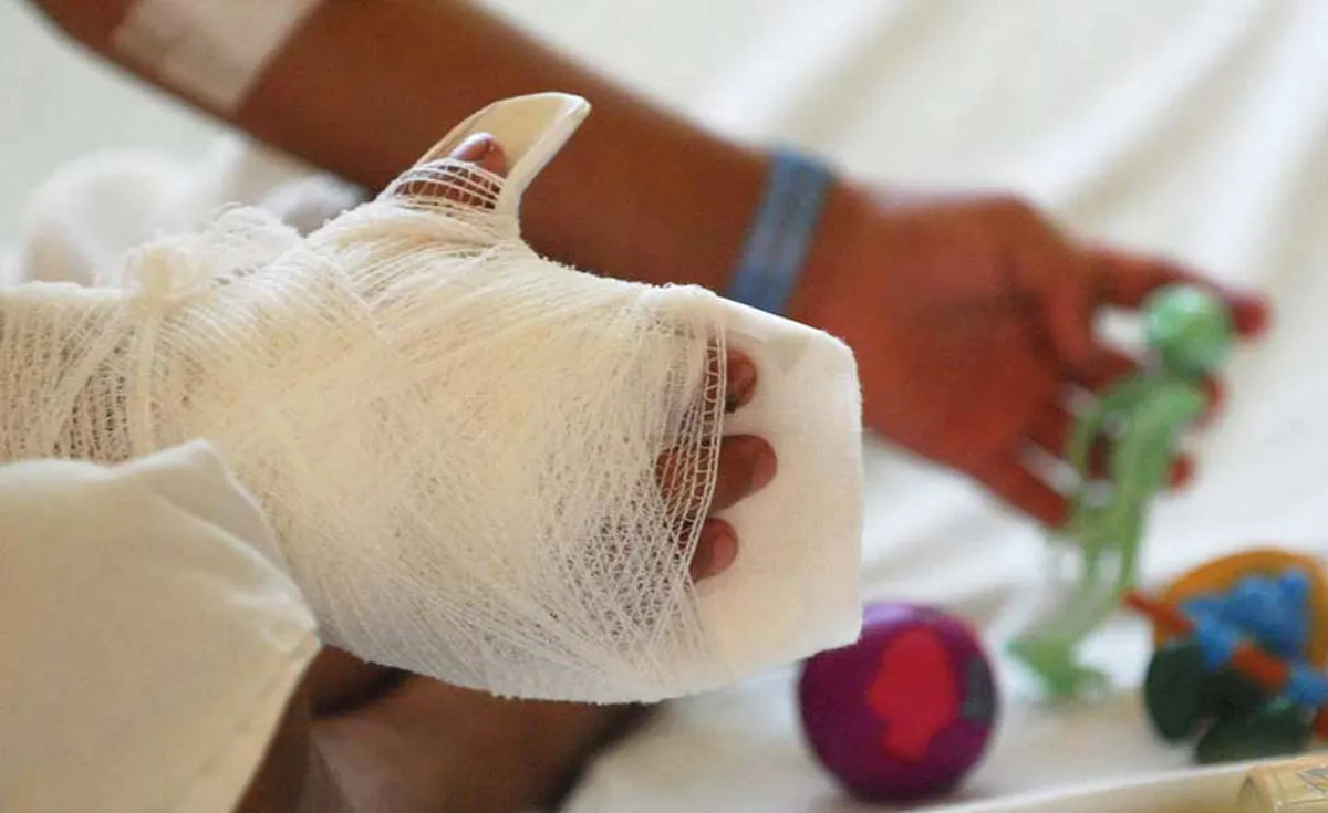Más de mil personas lesionadas por pólvora en Colombia durante diciembre