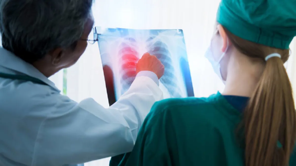 El 85 % de los casos de cáncer de pulmón podrían prevenirse con hábitos saludables