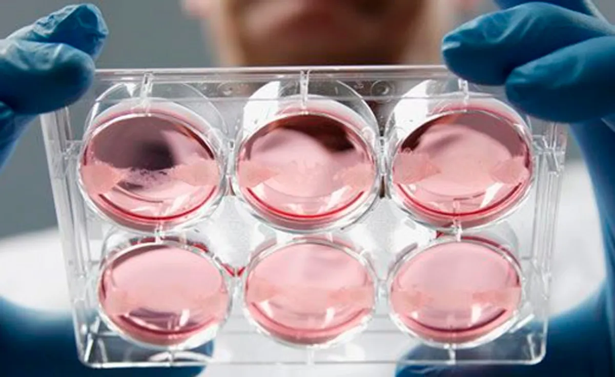 Células madre: alternativa en la medicina regenerativa y la salud articular