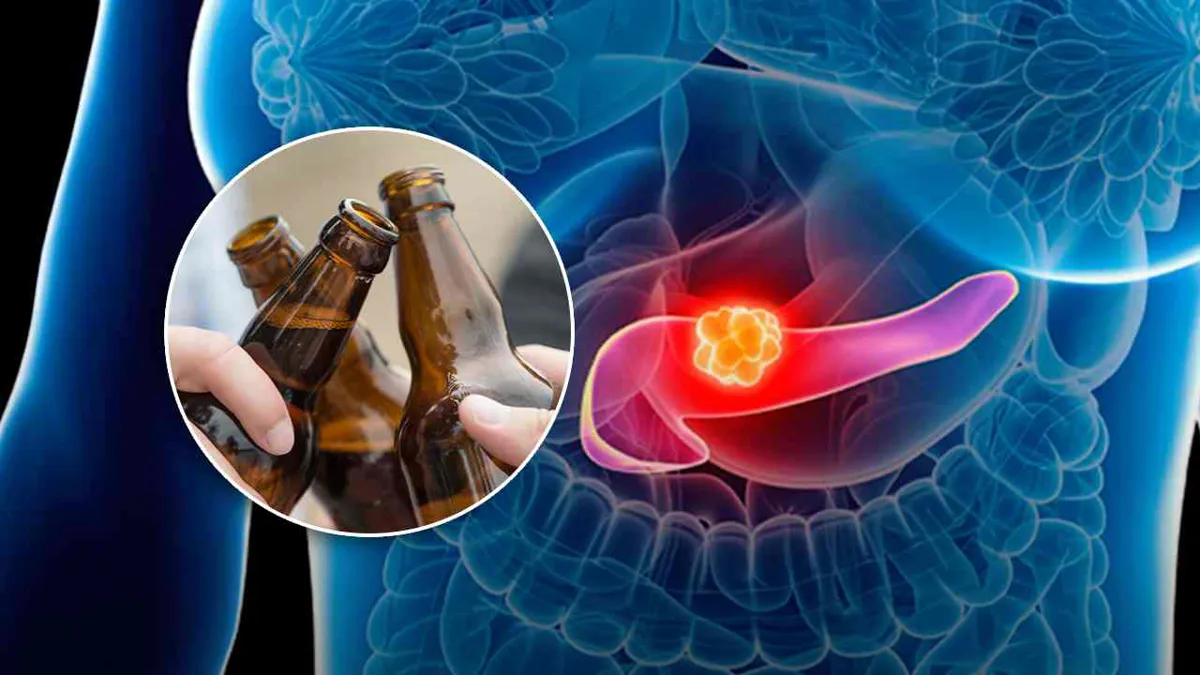 Un estudio vincula el consumo de alcohol con una mayor incidencia del cáncer de páncreas