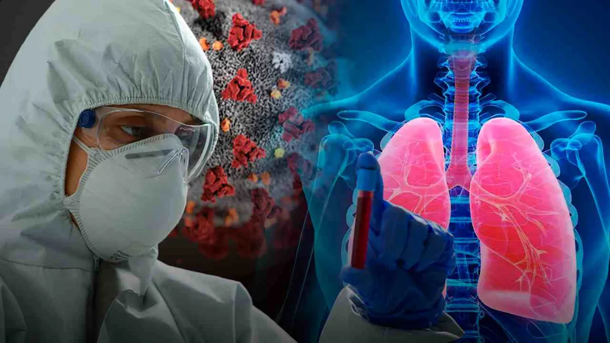 La tuberculosis supera la COVID-19 y vuelve a ser la enfermedad infecciosa más mortal