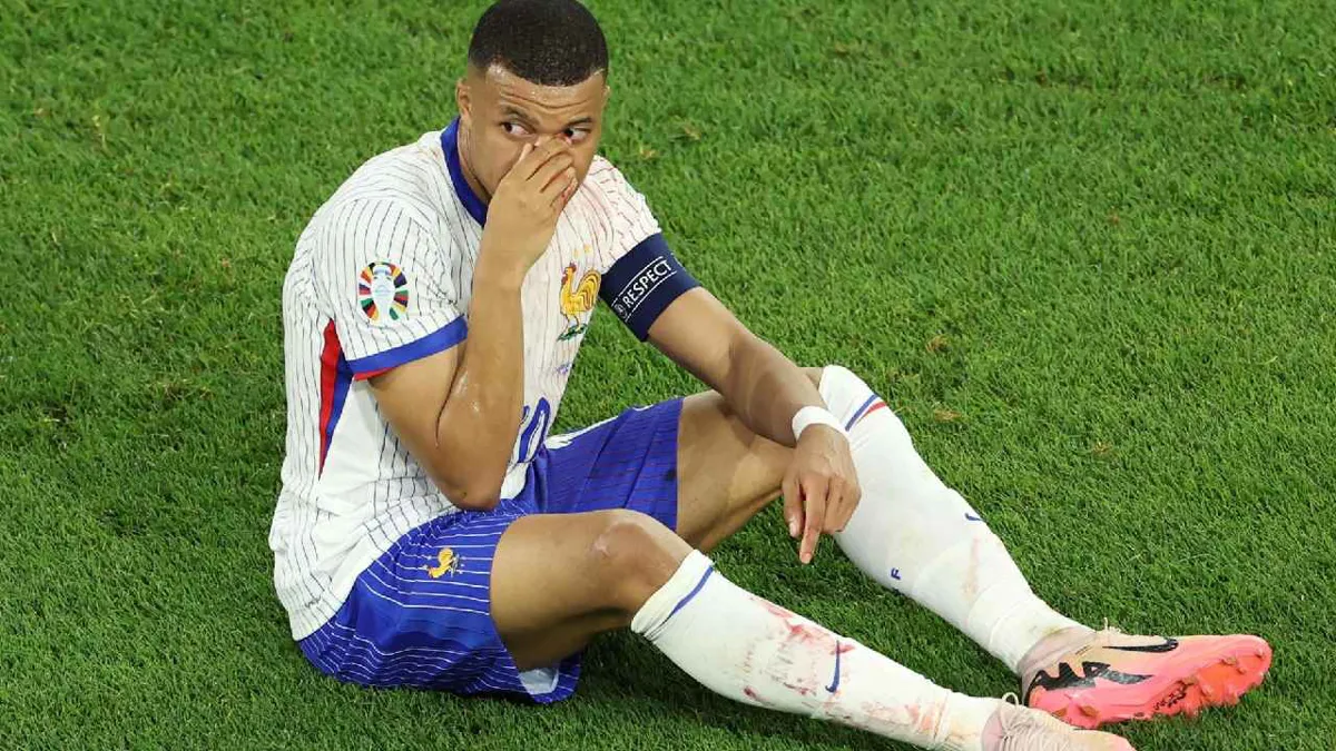 Mbappé sufre fractura de nariz y tendrá que ser operado
