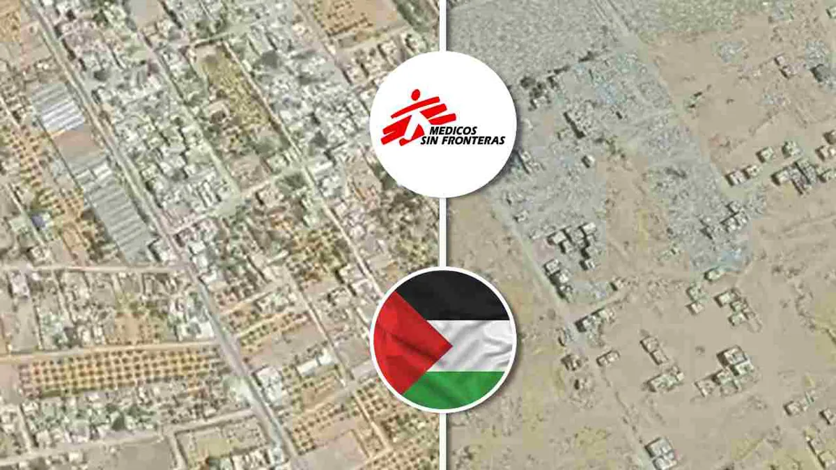 MSF atiende a 1.599 gazatíes desnutridos en ciudad de Gaza