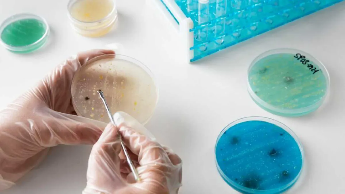 Descubren bacteria amazónica con propiedades anticancerígenas