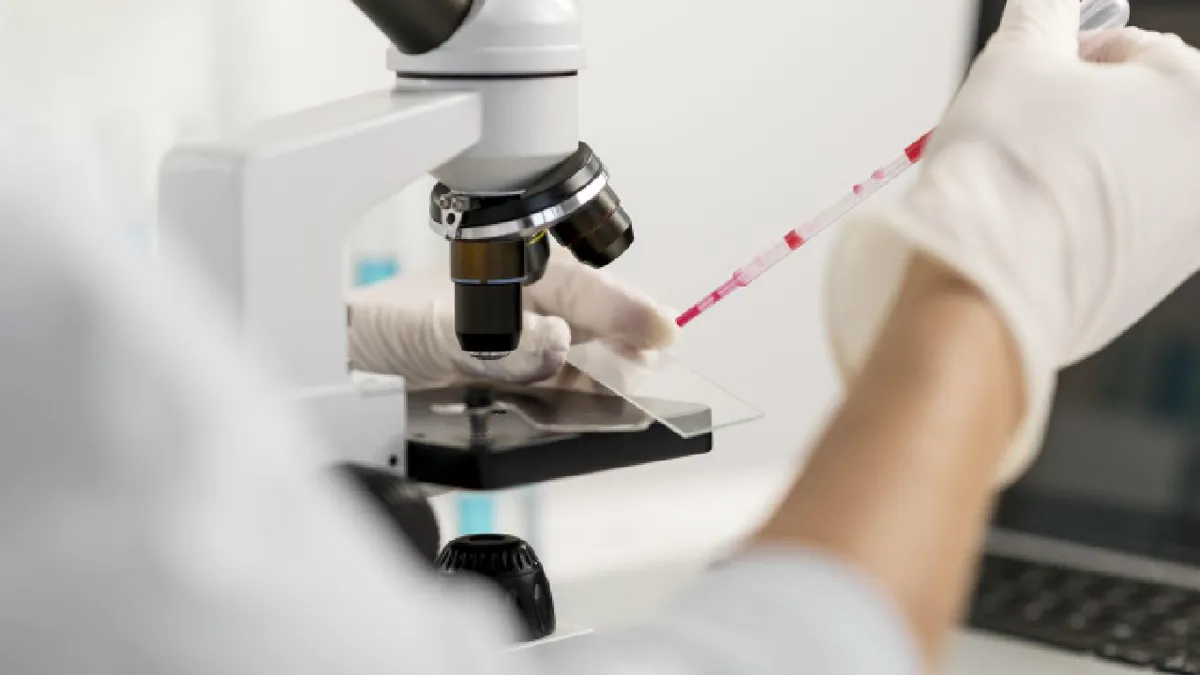 Tasas de cáncer de intestino aumentan por obesidad y alcohol